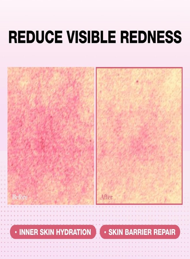 Physiogel Red Soothing Essence, Reduces Redness, Hydration for Dry & Sensitive Skin, Fragrance-Free, Non-Comedogenic, Dermatologist-Tested, Lightweight - Image 3